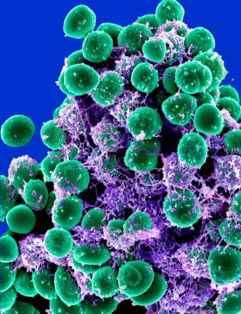 Ultraviolet germicidal light