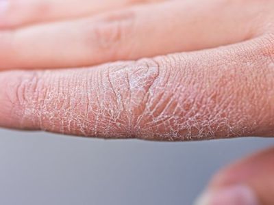 sign of hard water